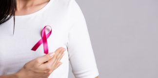 乳癌患者示意圖