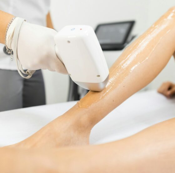 Laser hair removal process for woman's legs in Meridian, ID