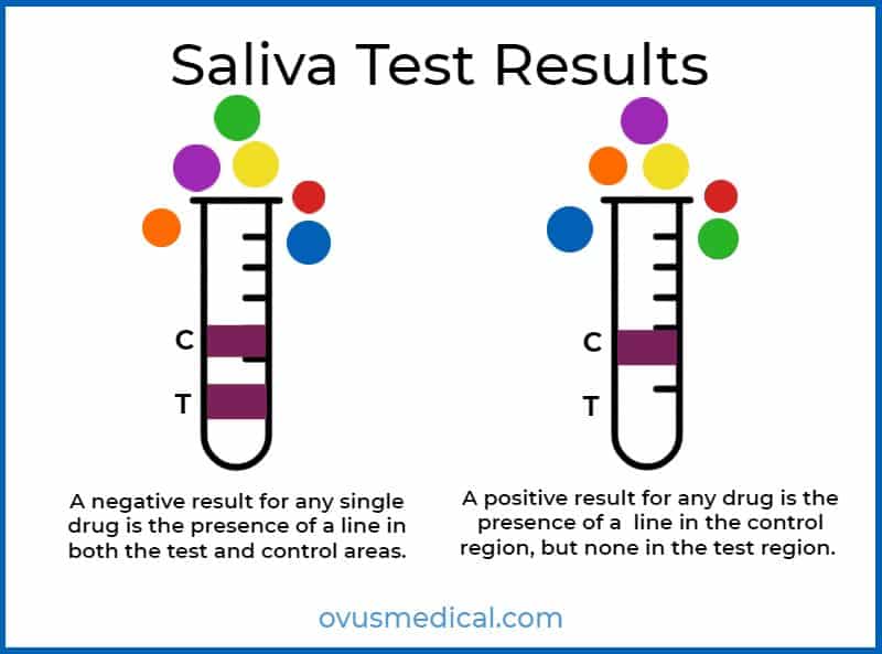ovus medical Saliva Test Results