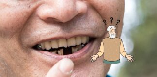 Periodontal Disease And Missing Teeth Increase The Risk Of Dementia