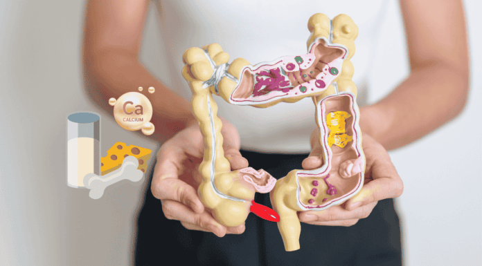 Calcium Bowel