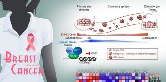 破解 乳癌增生移轉 的秘密？中研院蛋白質DSG2含量是關鍵!
