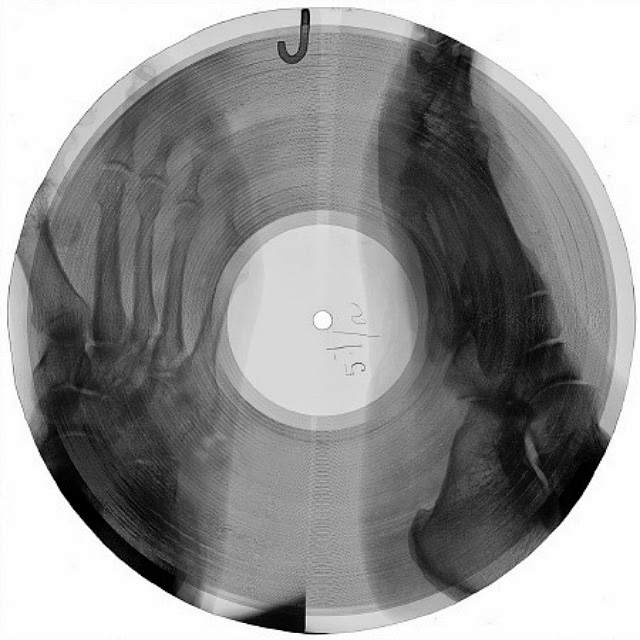 röntgenfoto met muziek