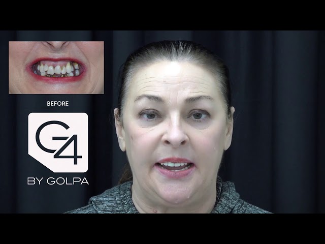 G4 By Golpa - Dallas - Patient: Audrey W