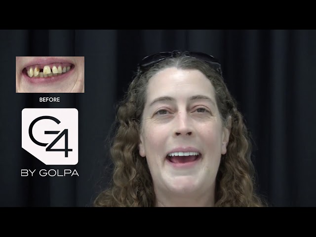 G4 By Golpa - Dallas - Patient: Astrid B