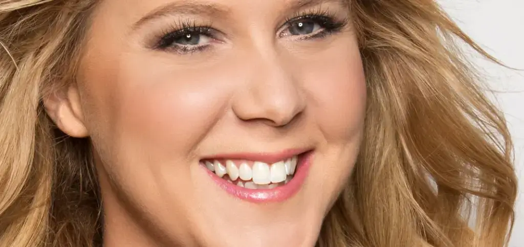 amy-schumer-hollywood-smile