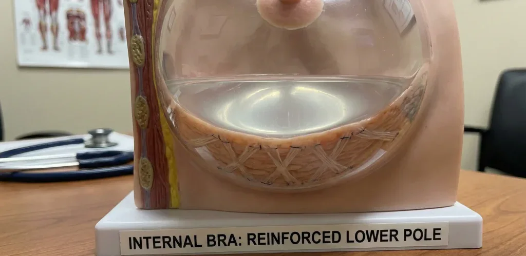 model anatomic detaliu de sutien intern pentru suportul zonei inferioare