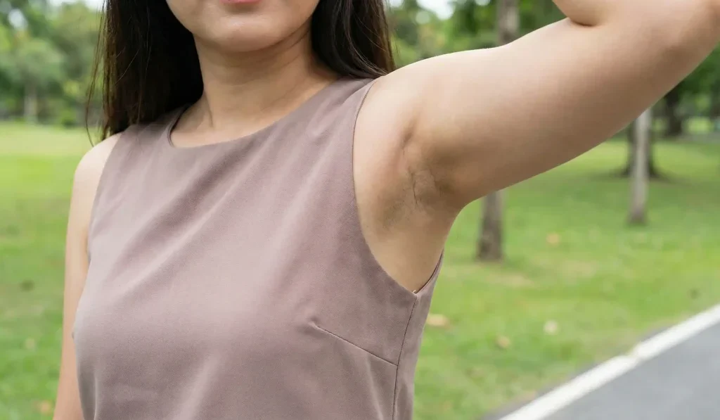 woman with axillary breast tissue bulge underarm park