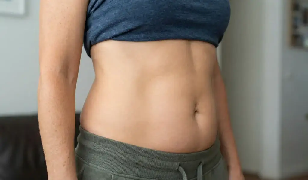 risultato a lungo termine della liposuzione con aumento di peso moderato