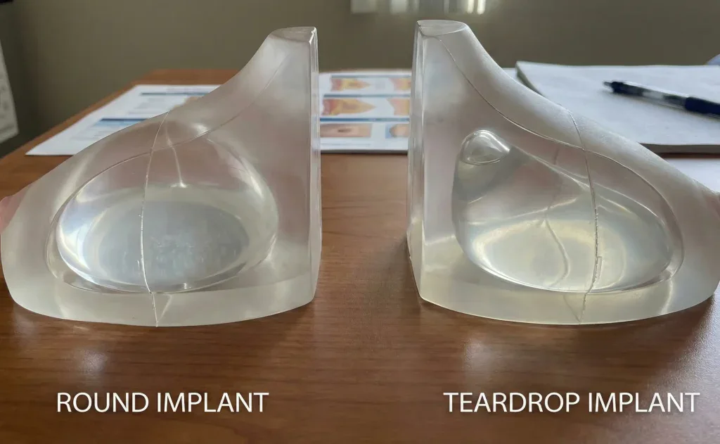 modele anatomice comparare profil rotund versus lacrimă