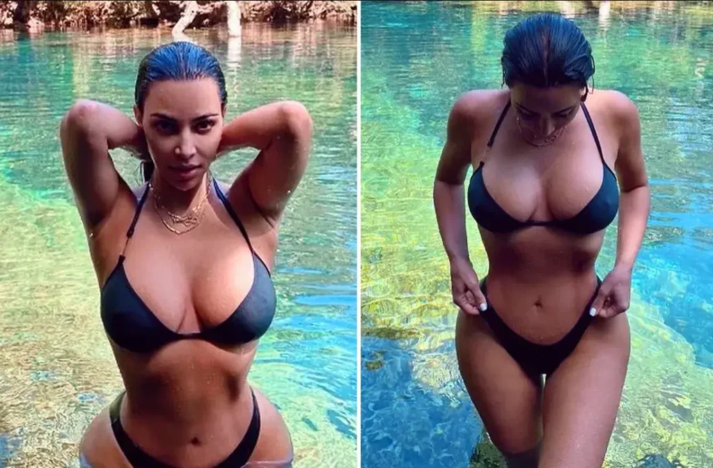 kim kardashians g&ouml;ğ&uuml;s implantları