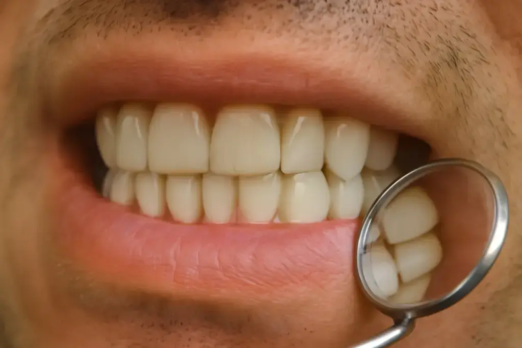 oral health and diabetes