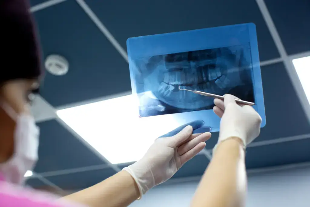 puede la radiografía dental causar cáncer