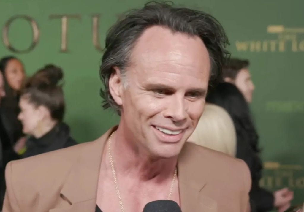 walton goggins tänder före och efter 2025