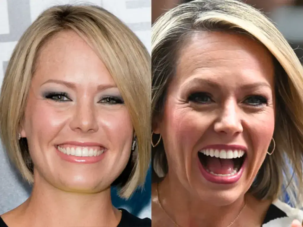 dylan dreyer teeth before after