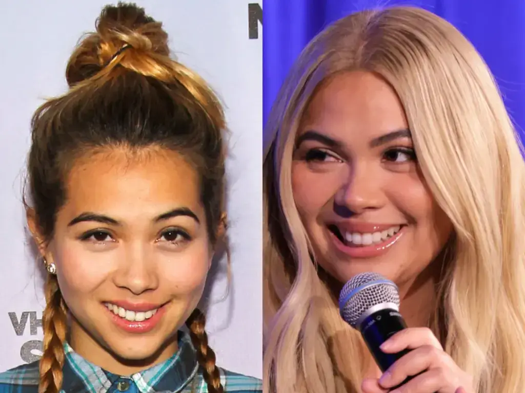 hayley kiyoko teeth before after