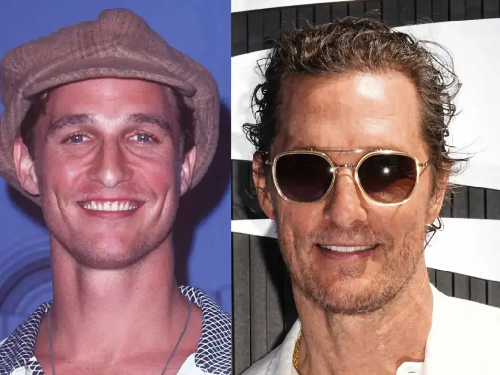 matthew mcconaughey z&auml;hne vorher nachher