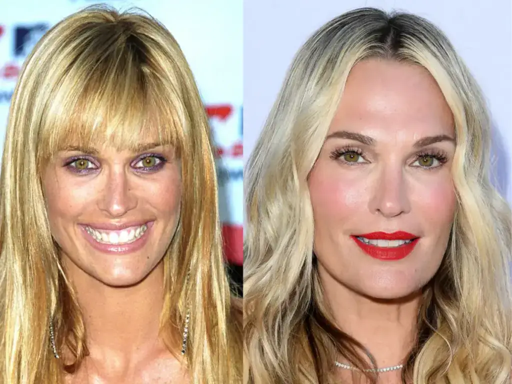 molly sims teeth before after