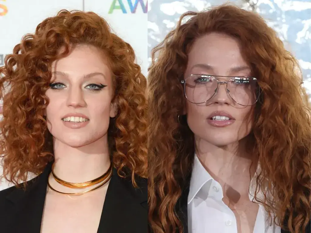 jess glynne t&auml;nder f&ouml;re och efter