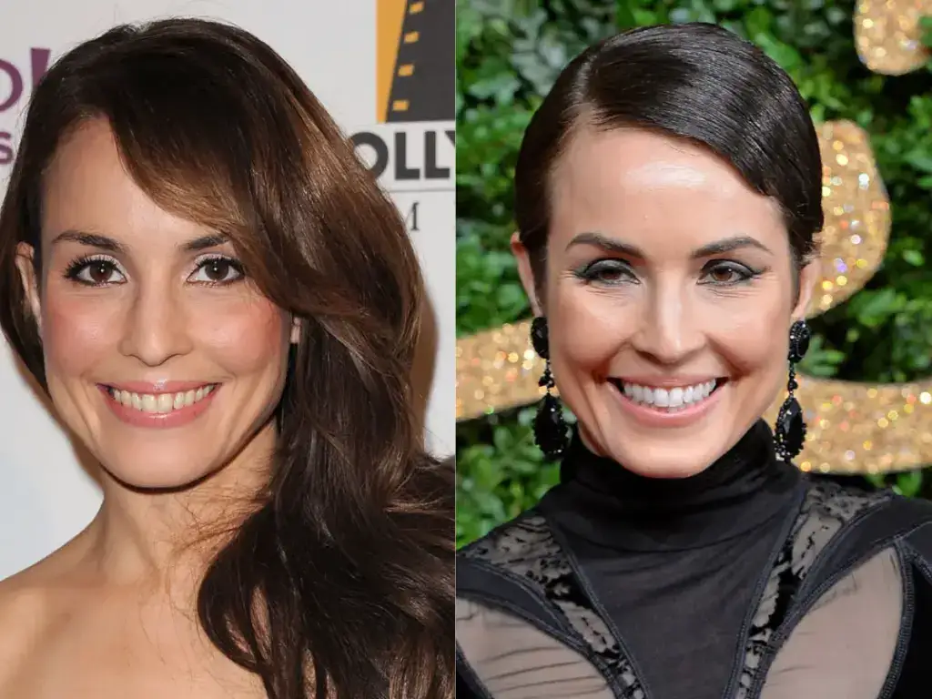 noomi rapace z&auml;hne vor nach