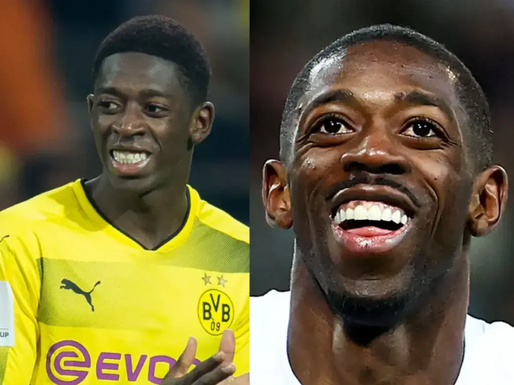 dinții lui Ousmane Demb&eacute;l&eacute; &icirc;nainte și după