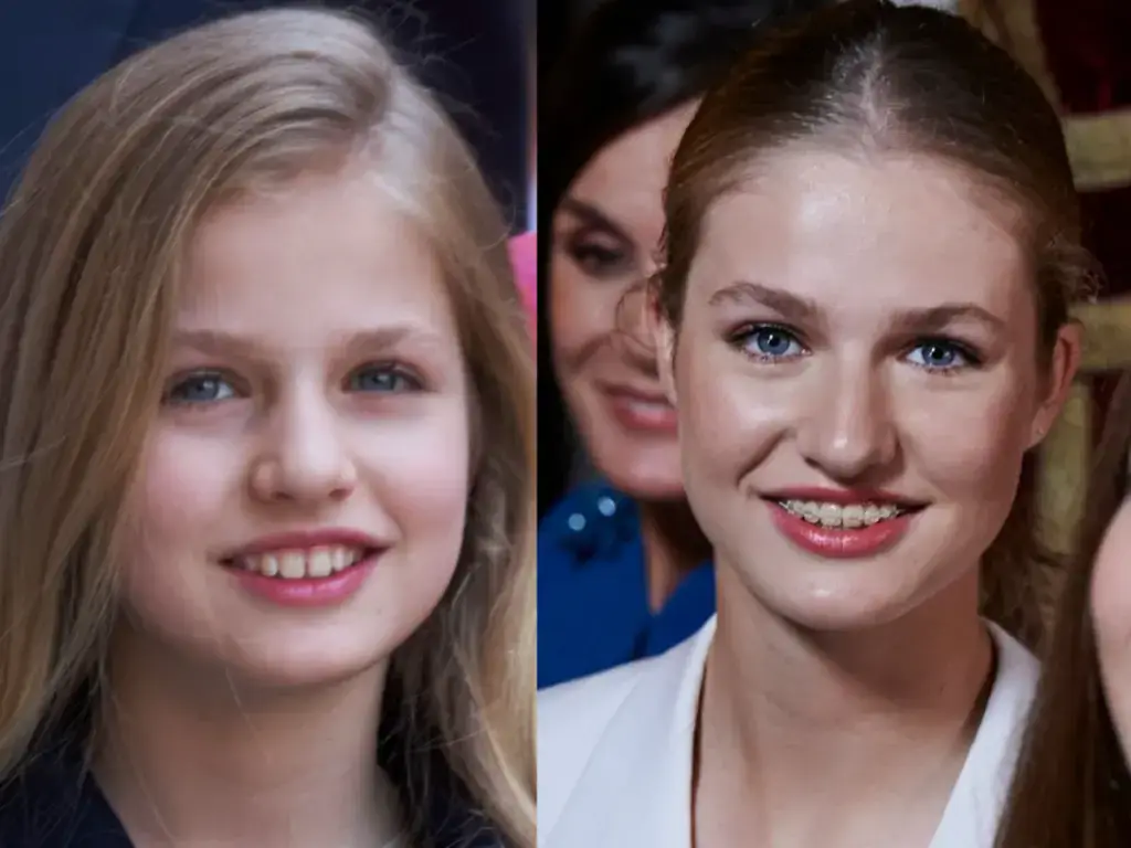 zęby księżniczki Leonor przed i po