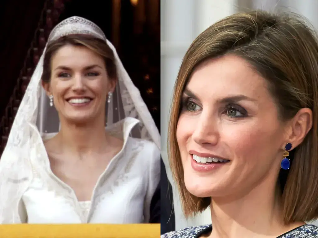 dientes de la reina letizia antes y despu&eacute;s