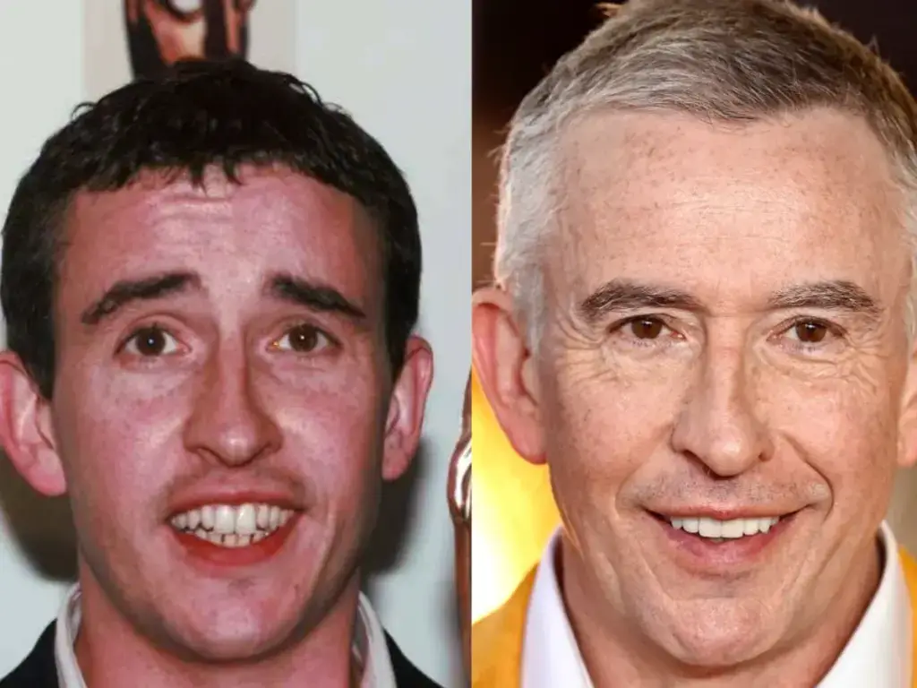 steve coogan hammaste enne ja p&auml;rast