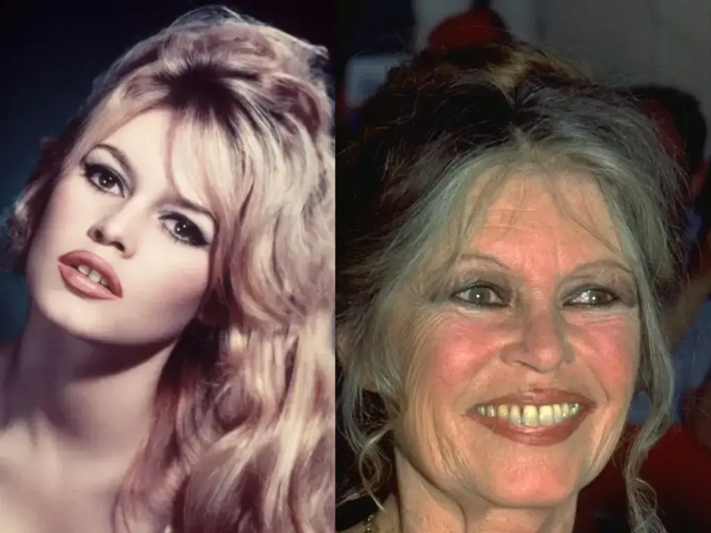 brigitte-bardot hammaste enne-j&auml;rgi