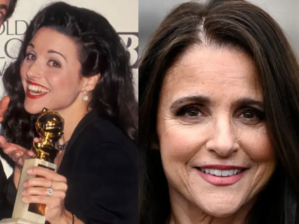 zeby julia louis dreyfus przed i po