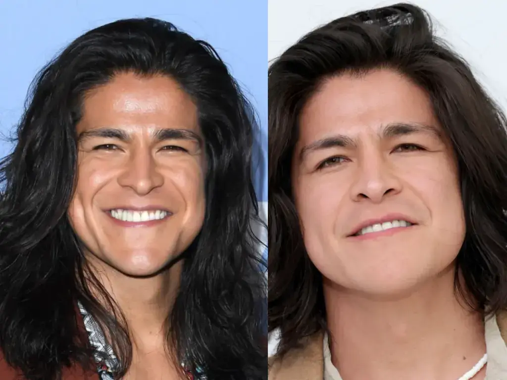 cristo fern&aacute;ndez teeth before after