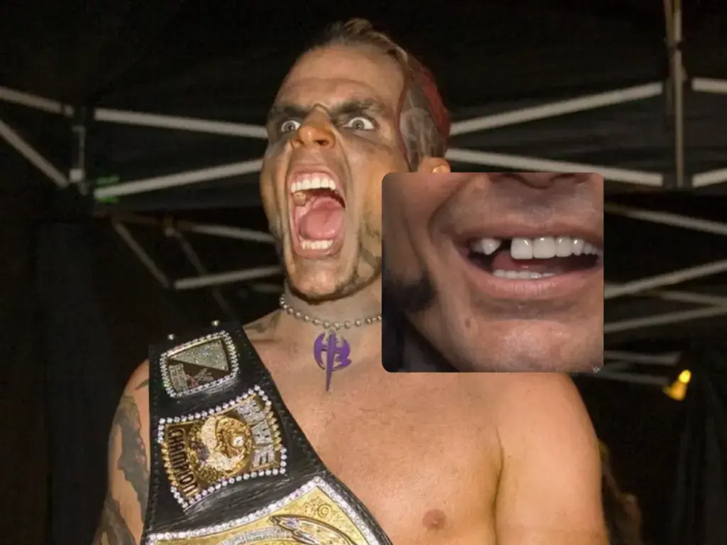 jeff hardy tannapples