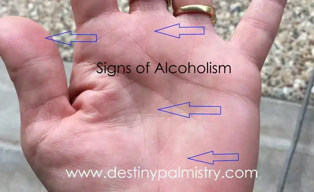 signs of alcoholism in palmistry