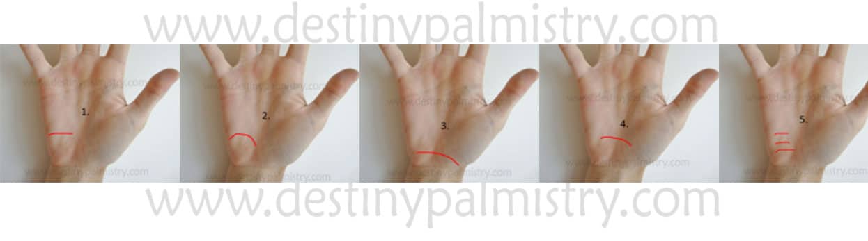 various types of allergy line or via lascivia