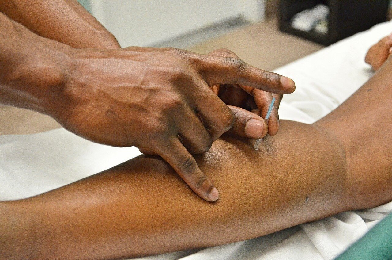 how does dry needling work