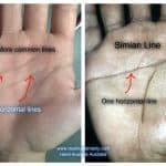 simian crease, simian line, palmistry, destiny, hand features, difficult child