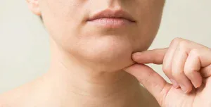 person pinching double chin fat pocket