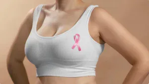 mastectomy