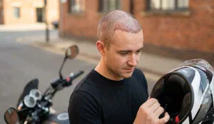patient motorcycle helmet post hair transplant examination