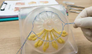 anatomical breast model purse string suture milk duct preservation