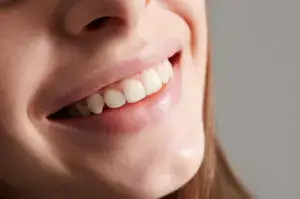 why do gums appear when smiling