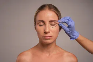 fox eye lift