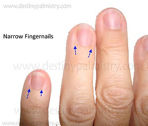 narrow fingernail meaning