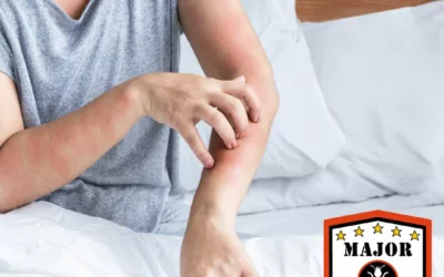 This Innovative Bed Bug Extermination Technique in Calgary is a Game Changer!