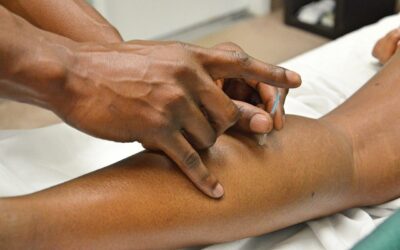 How Does Dry Needling Work?