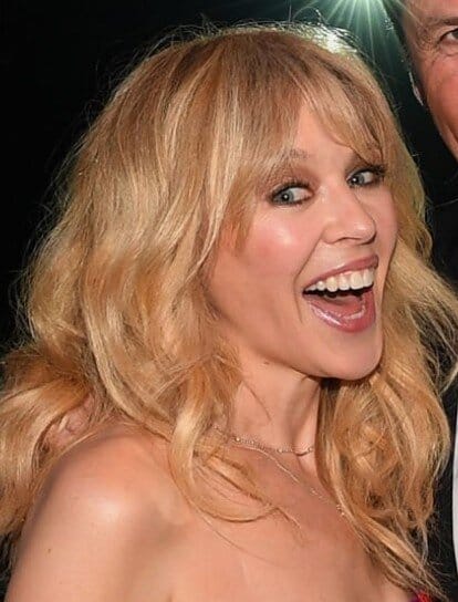 dinții lui kylie minogue &icirc;n 2017