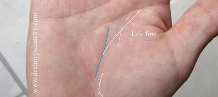 palm lines, life line is broken, break in life line,