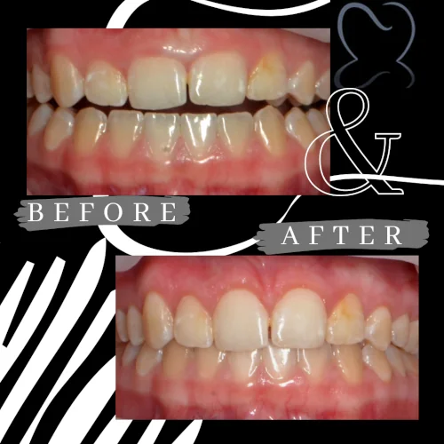 Before and After Cosmetic Dental Procedures by Dr. Suffoletta
