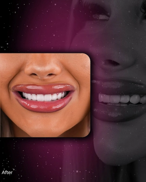 &bdquo;LEMA Dental Clinic&ldquo; kuriame ne tik jūsų &scaron;ypseną, bet ir jūsų komfortą &ndash; sklandžią patirtį (4)