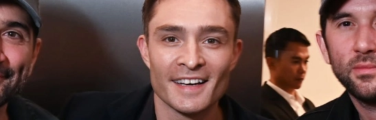 ed-westwick-teeth-in-2025